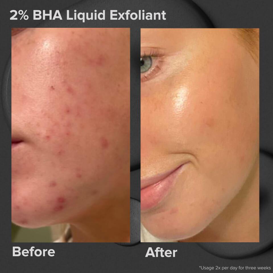 EXFOLIANT LIQUIDE PERFECTEUR DE PEAU 2 % BHA DE PAULA'S CHOICE - FORMAT D'ESSAI (30 ML)