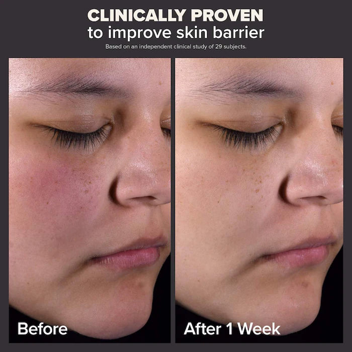 Paula's Choice
Skin Perfecting 2% BHA Liquid Exfoliant for Clear Skin 118 ml