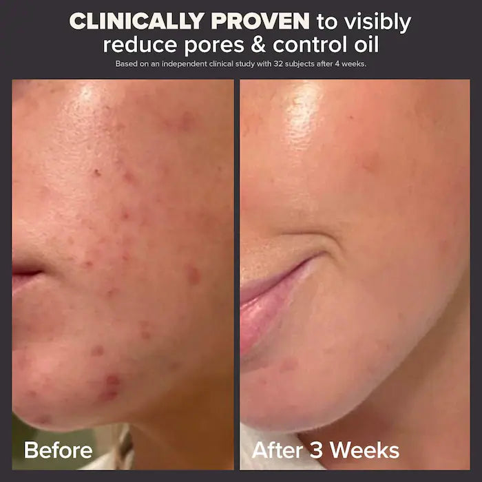 Paula's Choice
Skin Perfecting 2% BHA Liquid Exfoliant for Clear Skin 118 ml