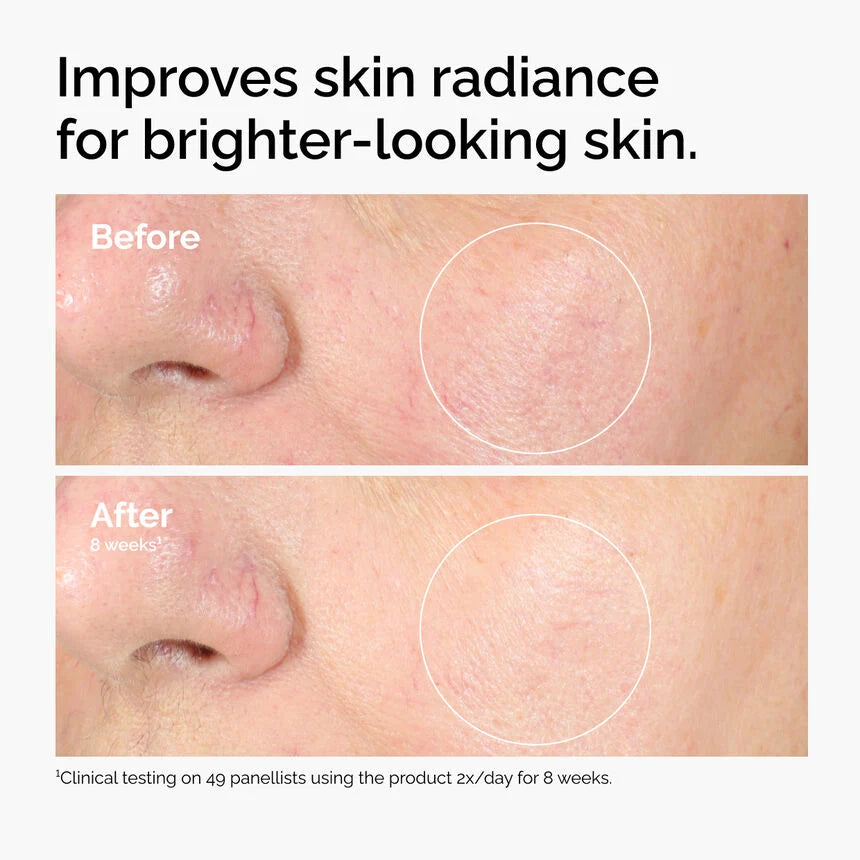 The Ordinary
Alpha Arbutin 2% 30 ml