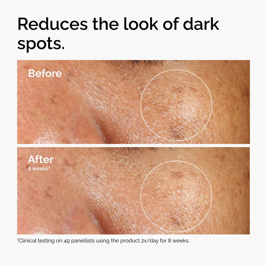 The Ordinary
Alpha Arbutin 2% 30 ml