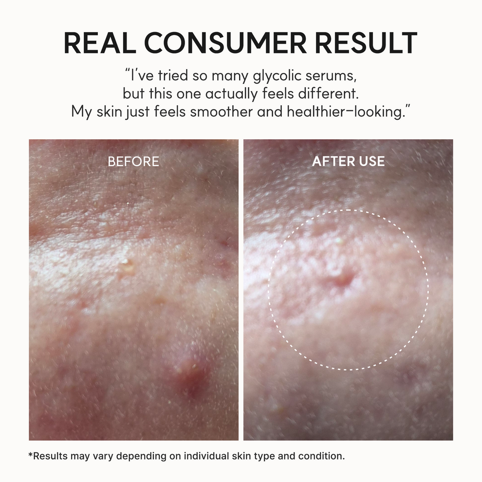 Arencia Eraser Shot Glycolic Acid Booster (30ml)