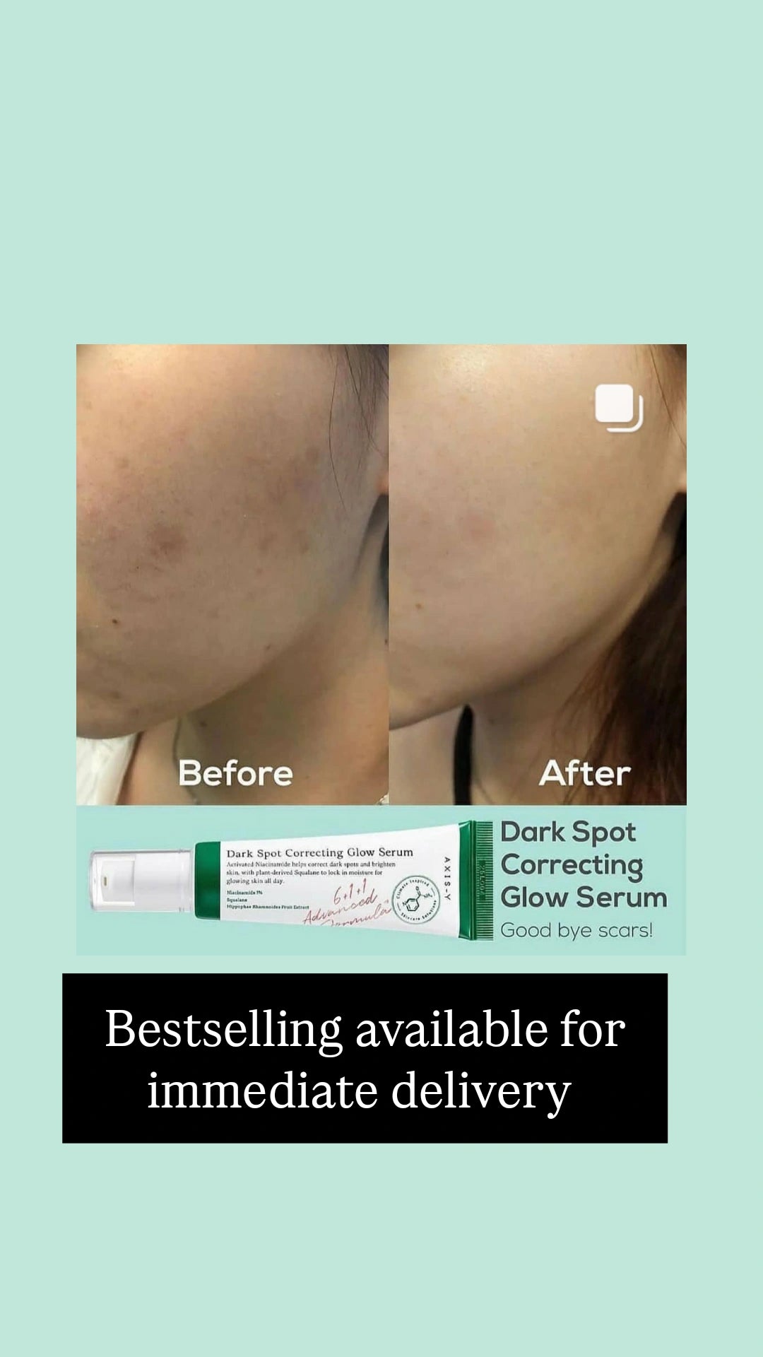 Axis-Y
Dark Spot Correcting Glow Serum 50ml