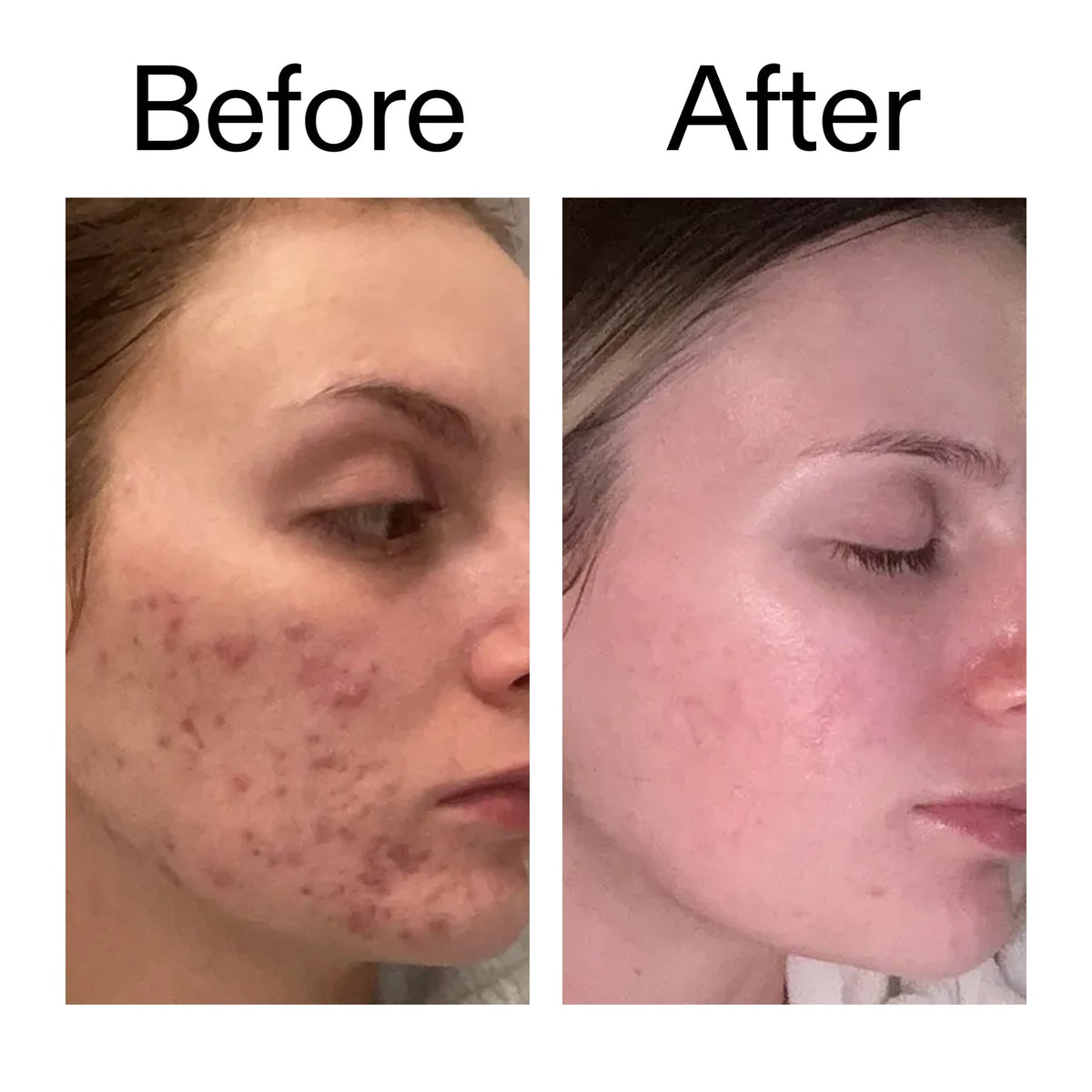 The inkeylist Salicylic Acid Cleanser - 150ml