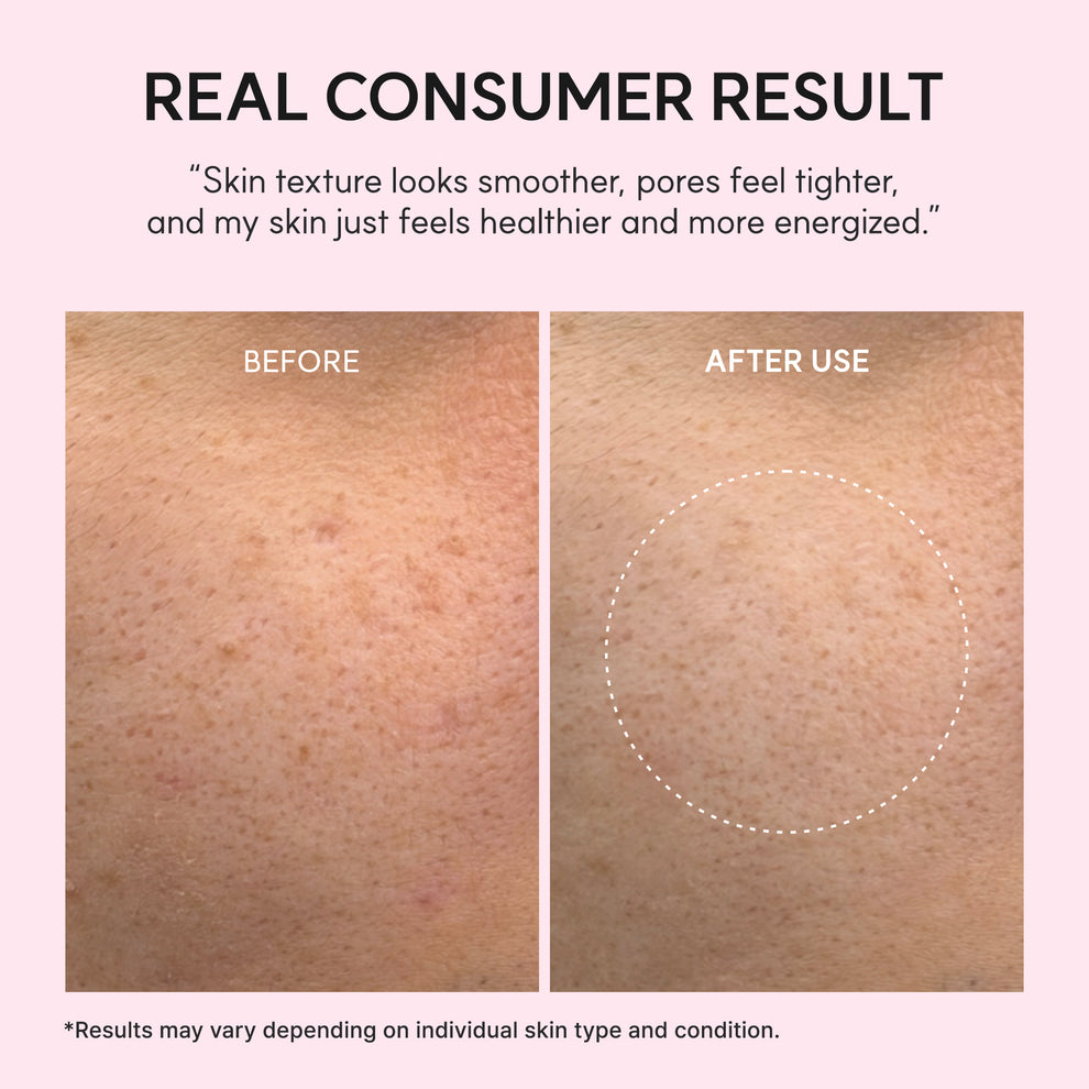 Arencia PDRN Booster Shot, Rosy-PDRN & Peptides for Glowy, Healthy Skin - Recommended for Sensitive, Red Skin