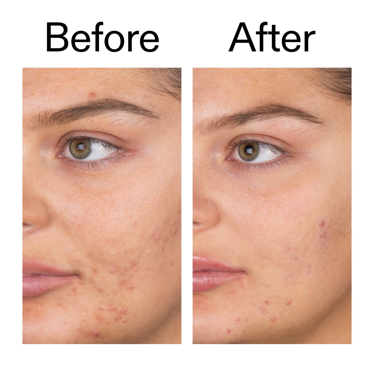 The inkeylist Salicylic Acid Cleanser - 150ml