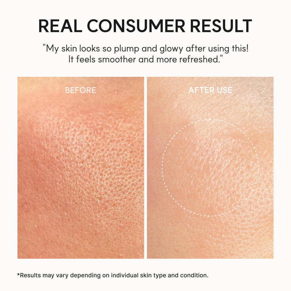 Arencia NAD+ Time-Rewind Booster Shot, Firming & Revitalizing Serum with 5% NAD+ Complex, Peptides & Resveratrol 30 ml
