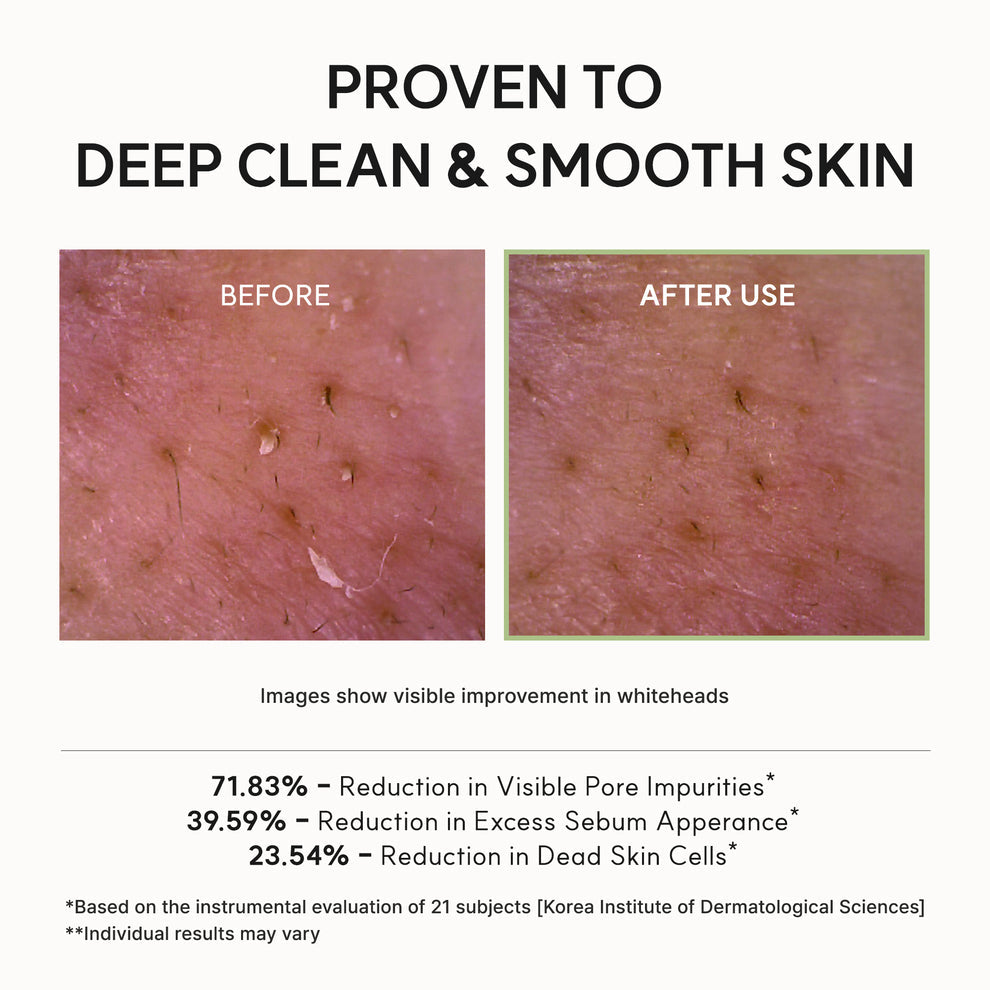 Arencia Fresh Green Rice Mochi Cleanser, Gentle Daily Cleanser for Congestion-Prone Skin size 120g