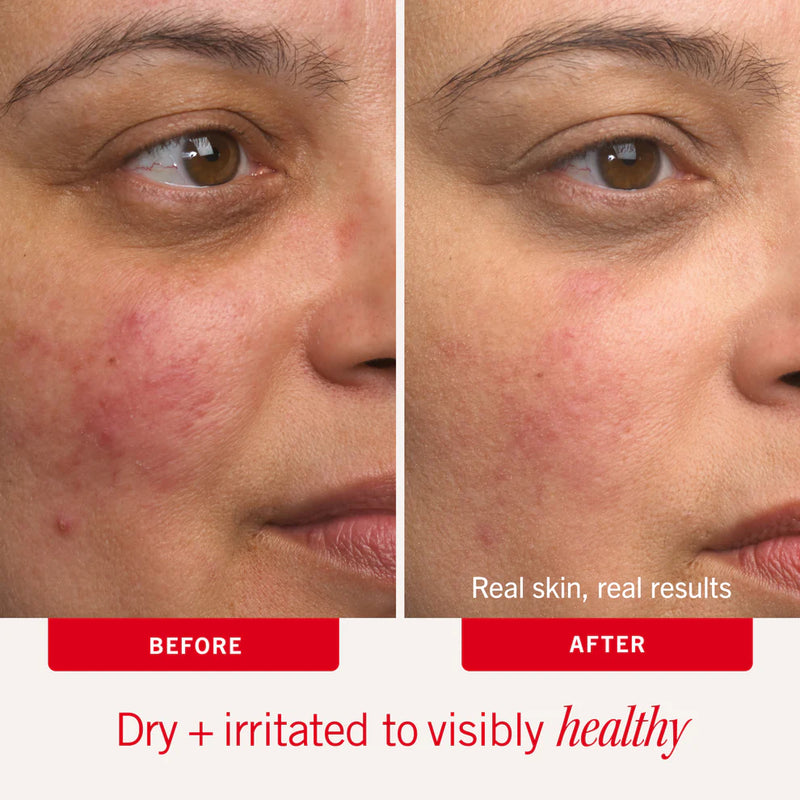 Ultra Repair Cream Intense Hydration 170g